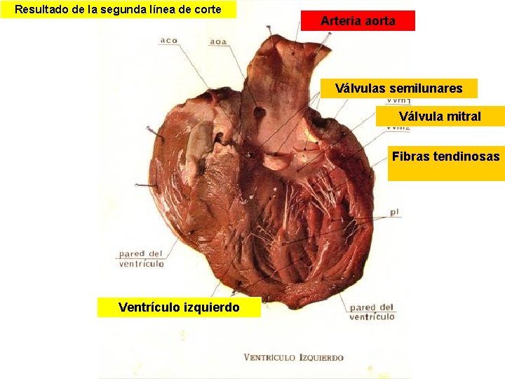 Resultado de la segunda línea de corte Arteria aorta Válvulas semilunares Válvula mitral Fibras