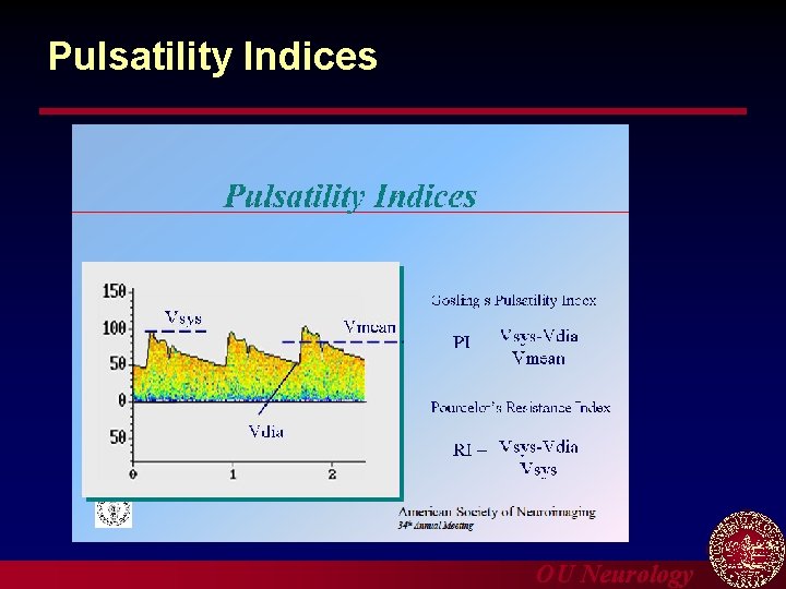 Pulsatility Indices OU Neurology 