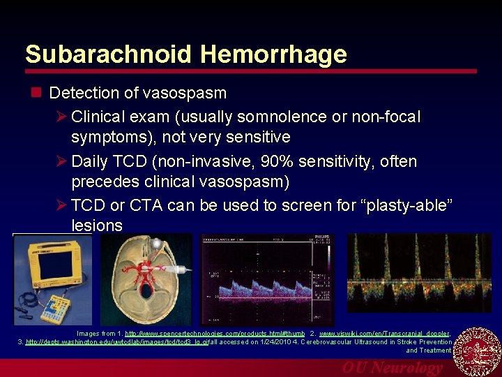 Subarachnoid Hemorrhage n Detection of vasospasm Ø Clinical exam (usually somnolence or non-focal symptoms),