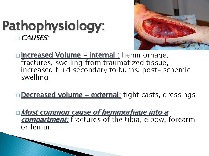 Pathophysiology: � CAUSES: � Increased Volume - internal : hemmorhage, fractures, swelling from traumatized