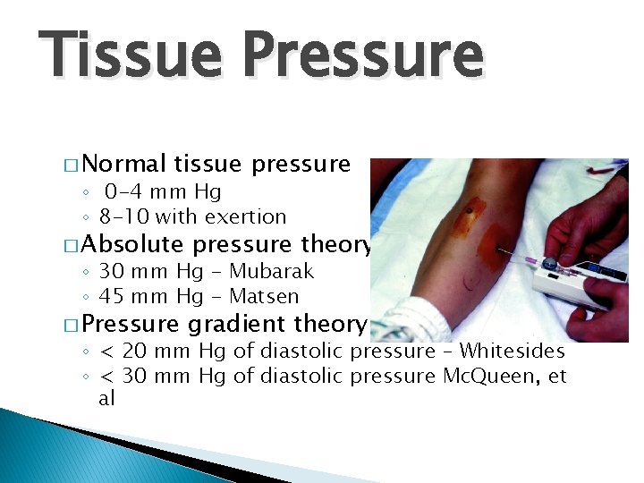 Tissue Pressure � Normal tissue pressure ◦ 0 -4 mm Hg ◦ 8 -10