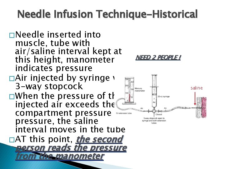 Needle Infusion Technique-Historical � Needle inserted into muscle, tube with air/saline interval kept at