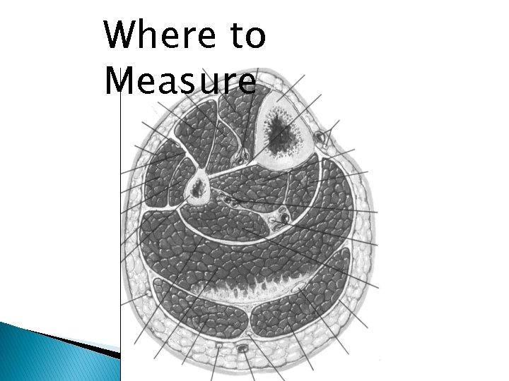 Where to Measure 