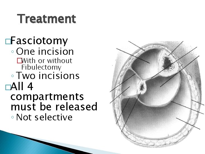 Treatment �Fasciotomy ◦ One incision �With or without Fibulectomy ◦ Two incisions �All 4
