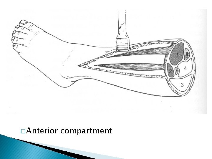 � Anterior compartment 