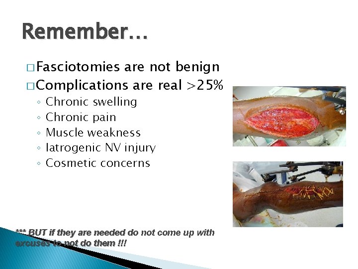 Remember… � Fasciotomies are not benign � Complications are real >25% ◦ ◦ ◦