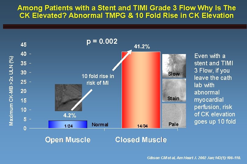 Among Patients with a Stent and TIMI Grade 3 Flow Why Is The CK