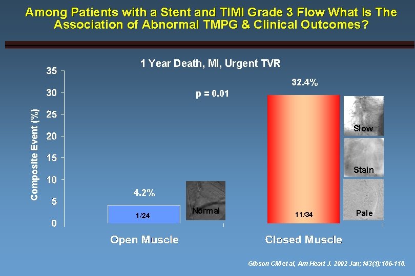 Among Patients with a Stent and TIMI Grade 3 Flow What Is The Association