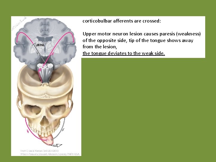 corticobulbar afferents are crossed: Upper motor neuron lesion causes paresis (weakness) of the opposite