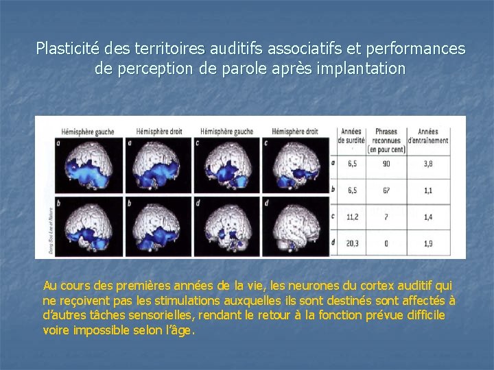 Plasticité des territoires auditifs associatifs et performances de perception de parole après implantation Au