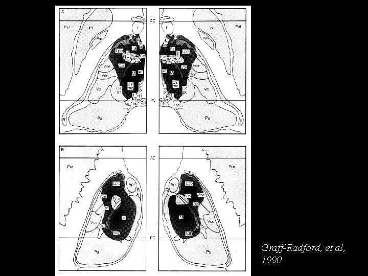 Graff-Radford, et al, 1990 