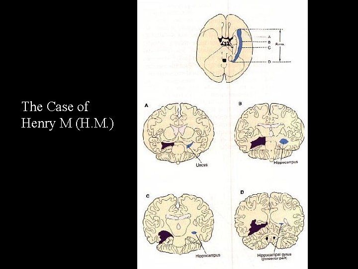 The Case of Henry M (H. M. ) 