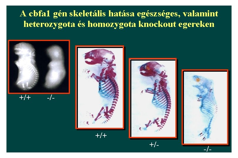 A cbfa 1 gén skeletális hatása egészséges, valamint heterozygota és homozygota knockout egereken +/+