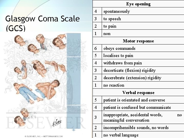 Eye opening Glasgow Coma Scale (GCS) 4 spontaneously 3 to speech 2 to pain Eye opening Glasgow Coma Scale (GCS) 4 spontaneously 3 to speech 2 to pain