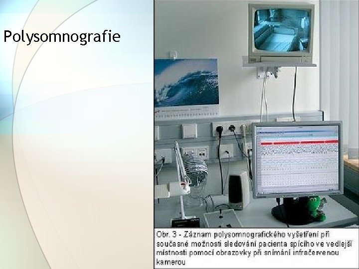 Polysomnografie Polysomnografie