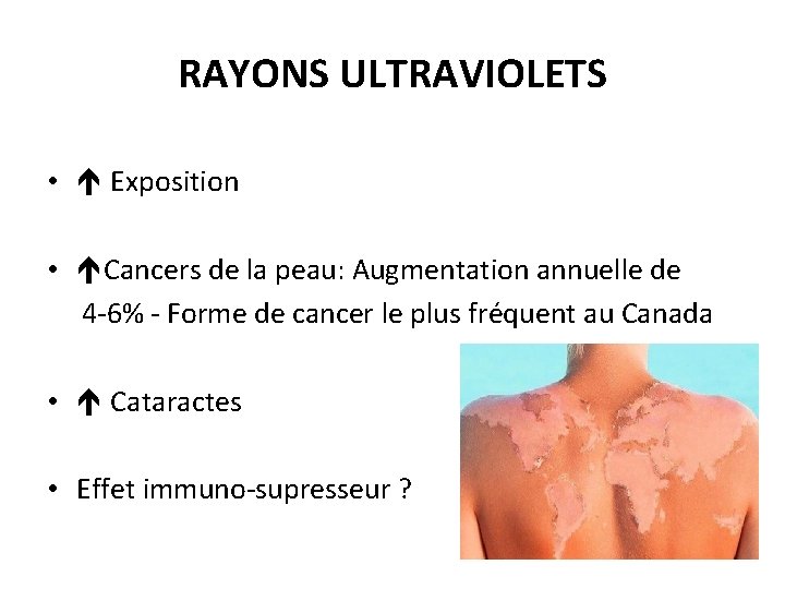 RAYONS ULTRAVIOLETS • Exposition • Cancers de la peau: Augmentation annuelle de 4 -6%