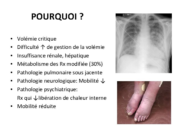 POURQUOI ? Volémie critique Difficulté ↑ de gestion de la volémie Insuffisance rénale, hépatique