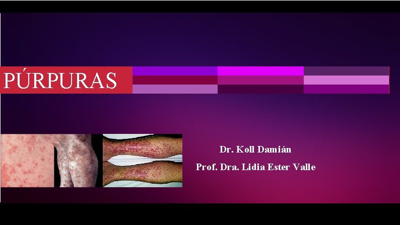 PÚRPURAS Dr. Koll Damián Prof. Dra. Lidia Ester Valle 