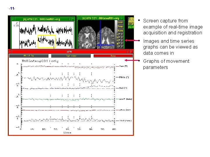 -11 - • Screen capture from example of real-time image acquisition and registration •