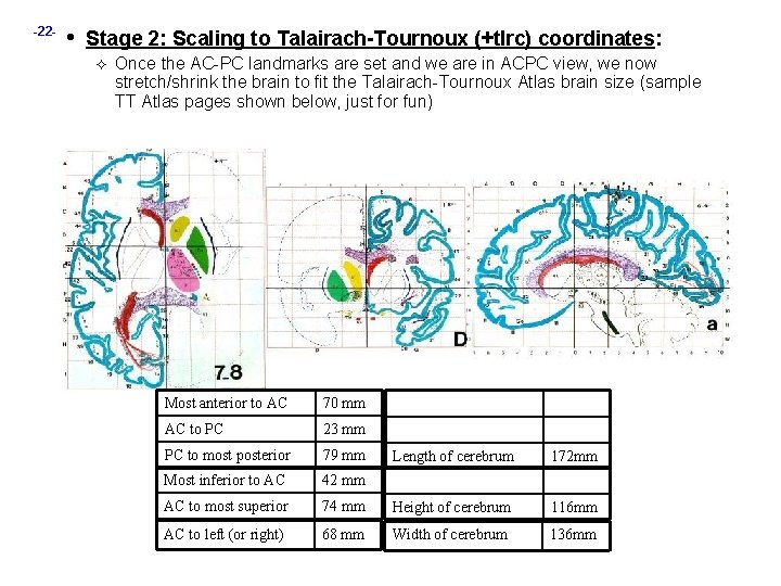 -22 - • Stage 2: Scaling to Talairach-Tournoux (+tlrc) coordinates: Once the AC-PC landmarks