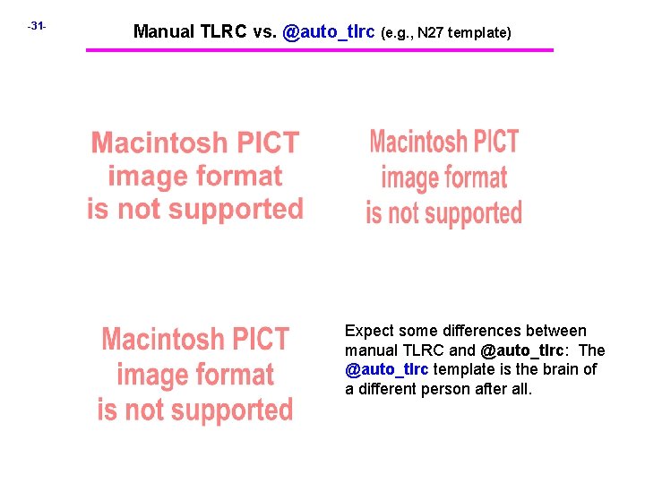 -31 - Manual TLRC vs. @auto_tlrc (e. g. , N 27 template) Expect some