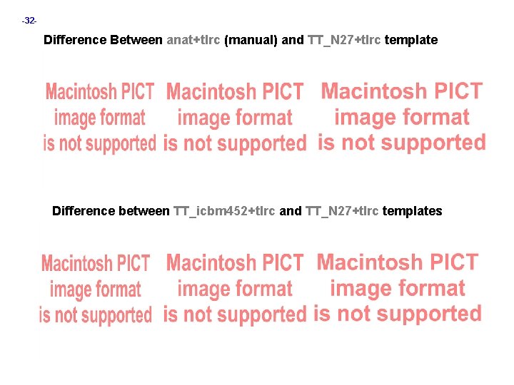 -32 - Difference Between anat+tlrc (manual) and TT_N 27+tlrc template Difference between TT_icbm 452+tlrc