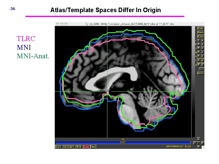 -34 - Atlas/Template Spaces Differ In Origin TLRC MNI-Anat. 