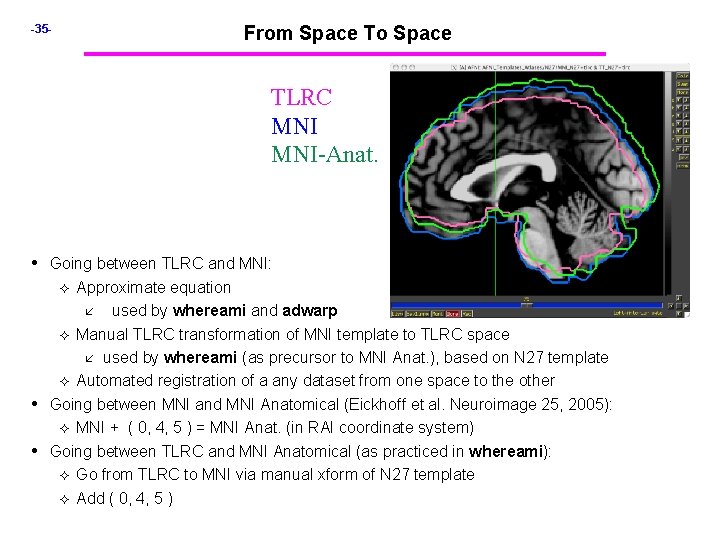 -35 - From Space To Space TLRC MNI-Anat. • Going between TLRC and MNI: