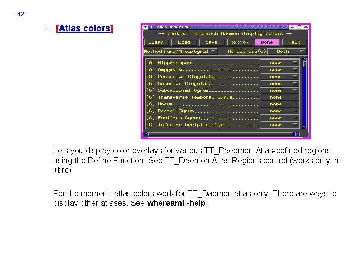 -42 - [Atlas colors] Lets you display color overlays for various TT_Daeomon Atlas-defined regions,