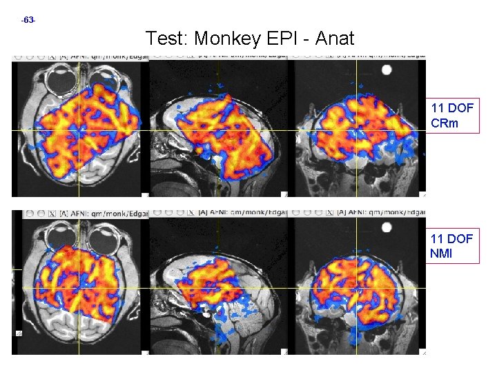 -63 - Test: Monkey EPI - Anat 11 DOF CRm 11 DOF NMI 