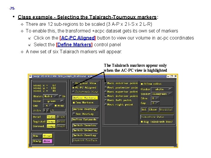 -75 - • Class example - Selecting the Talairach-Tournoux markers: There are 12 sub-regions