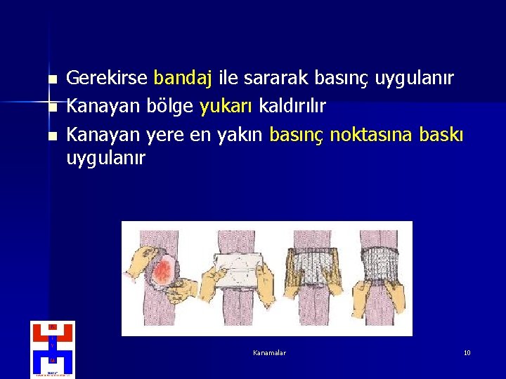 n n n Gerekirse bandaj ile sararak basınç uygulanır Kanayan bölge yukarı kaldırılır Kanayan