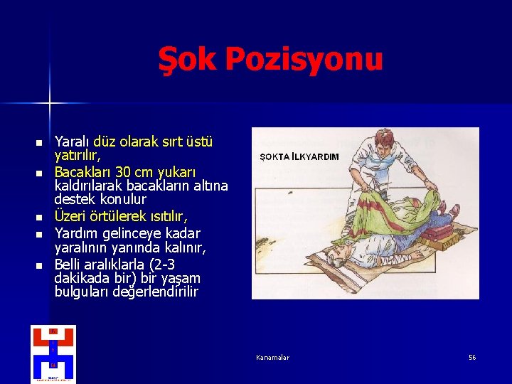Şok Pozisyonu n n n Yaralı düz olarak sırt üstü yatırılır, Bacakları 30 cm