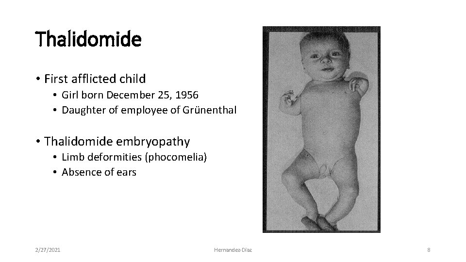 Thalidomide • First afflicted child • Girl born December 25, 1956 • Daughter of