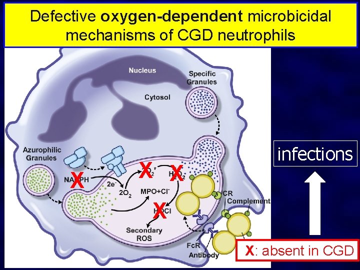 Defective oxygen-dependent microbicidal mechanisms of CGD neutrophils X X X infections X X: absent