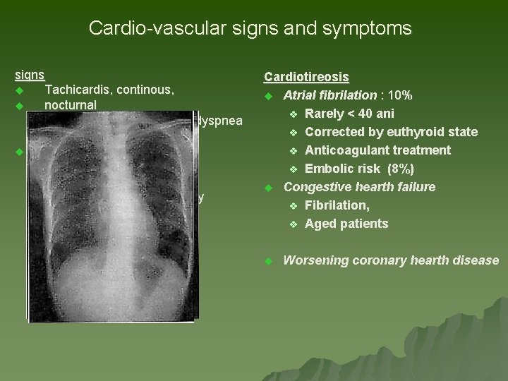 Cardio-vascular signs and symptoms signs u Tachicardis, continous, u nocturnal t + effort associated Cardio-vascular signs and symptoms signs u Tachicardis, continous, u nocturnal t + effort associated