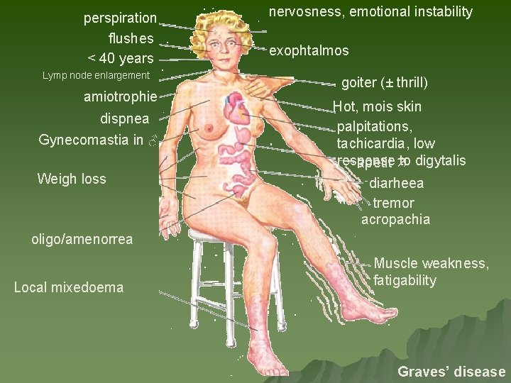 perspiration flushes < 40 years Lymp node enlargement amiotrophie dispnea Gynecomastia in ♂ Weigh perspiration flushes < 40 years Lymp node enlargement amiotrophie dispnea Gynecomastia in ♂ Weigh