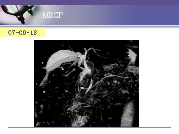 MRCP 07 -09 -13 