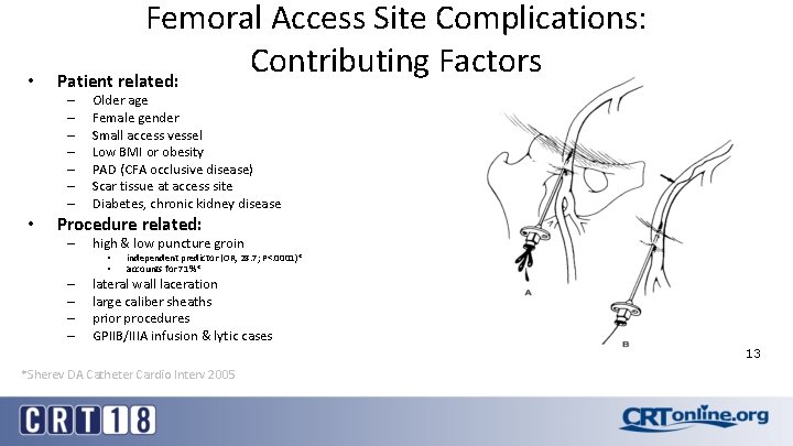  • Femoral Access Site Complications: Contributing Factors Patient related: – – – –