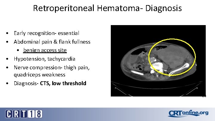 Retroperitoneal Hematoma- Diagnosis • Early recognition- essential • Abdominal pain & flank fullness •