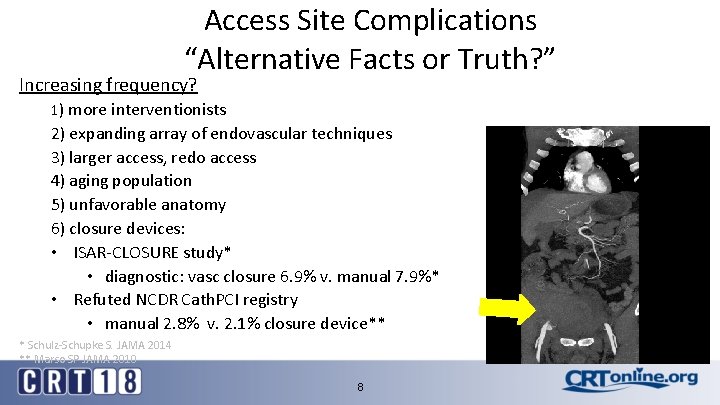 Access Site Complications “Alternative Facts or Truth? ” Increasing frequency? 1) more interventionists 2)