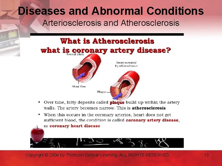 Diseases and Abnormal Conditions Arteriosclerosis and Atherosclerosis Copyright © 2004 by Thomson Delmar Learning.