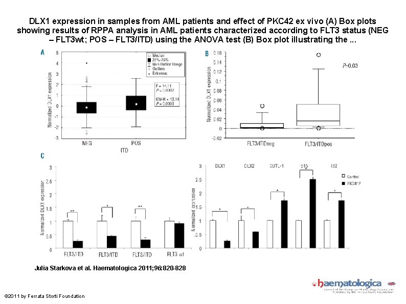 DLX 1 expression in samples from AML patients and effect of PKC 42 ex