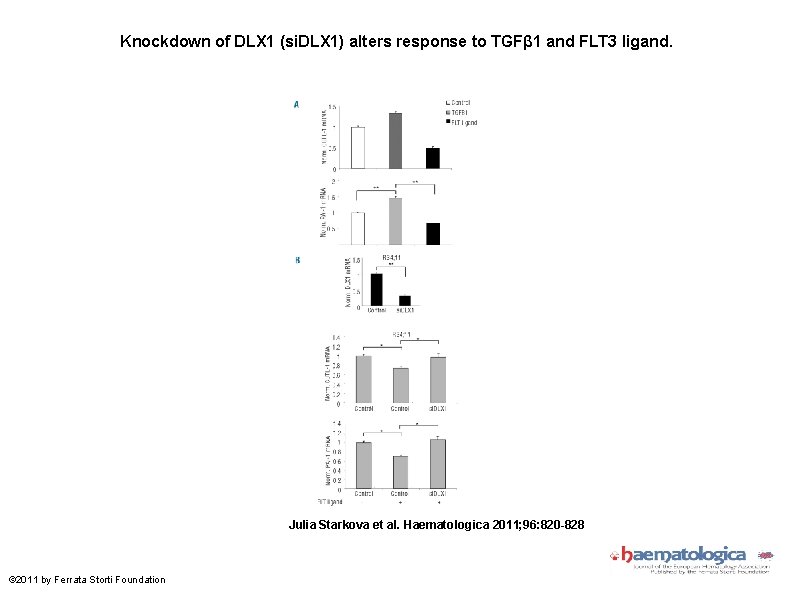 Knockdown of DLX 1 (si. DLX 1) alters response to TGFβ 1 and FLT