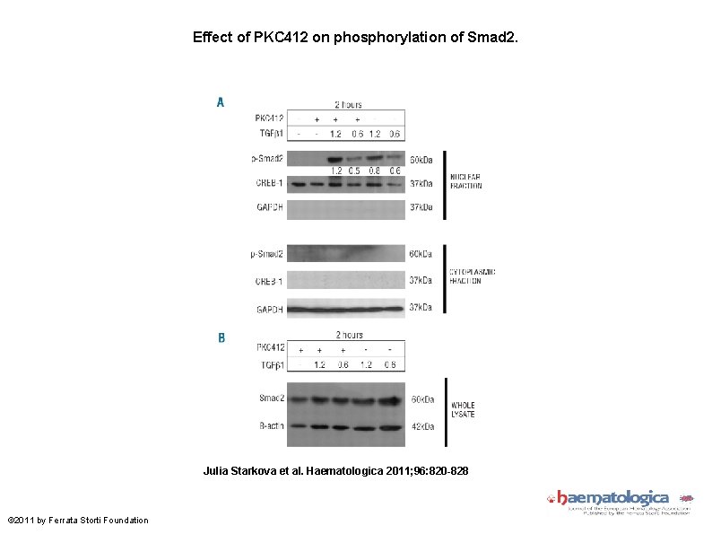 Effect of PKC 412 on phosphorylation of Smad 2. Julia Starkova et al. Haematologica