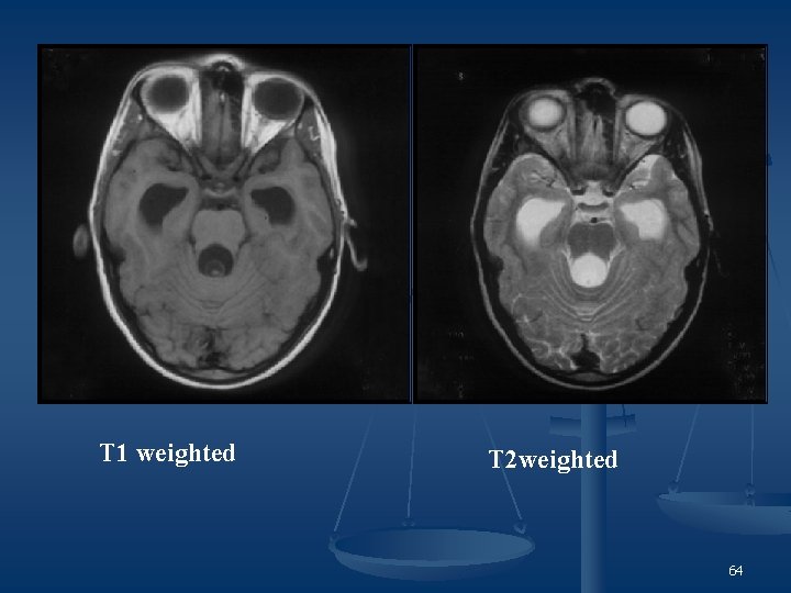 T 1 weighted T 2 weighted 64 