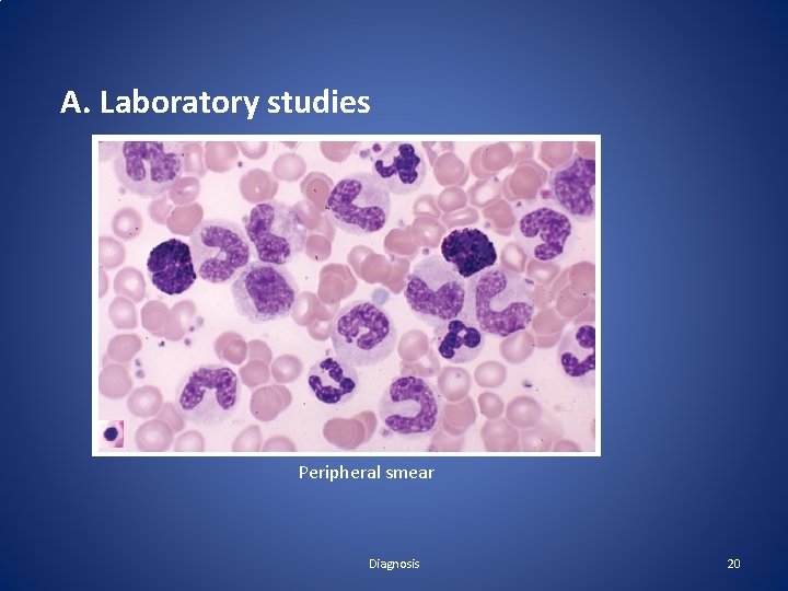 A. Laboratory studies Peripheral smear Diagnosis 20 