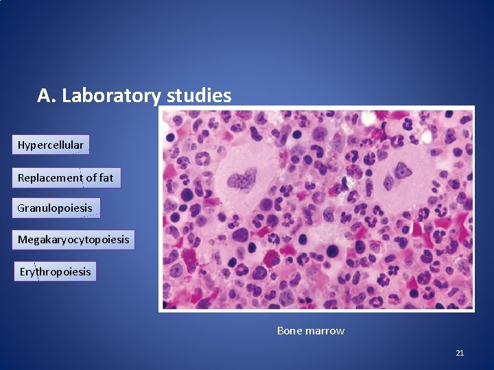 A. Laboratory studies Hypercellular Replacement of fat Granulopoiesis Megakaryocytopoiesis Erythropoiesis Bone marrow 21 