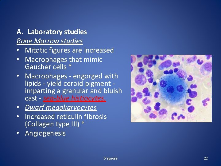 A. Laboratory studies Bone Marrow studies • Mitotic figures are increased • Macrophages that