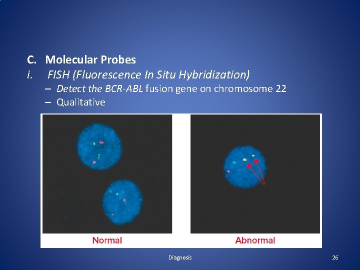 C. Molecular Probes i. FISH (Fluorescence In Situ Hybridization) – Detect the BCR-ABL fusion